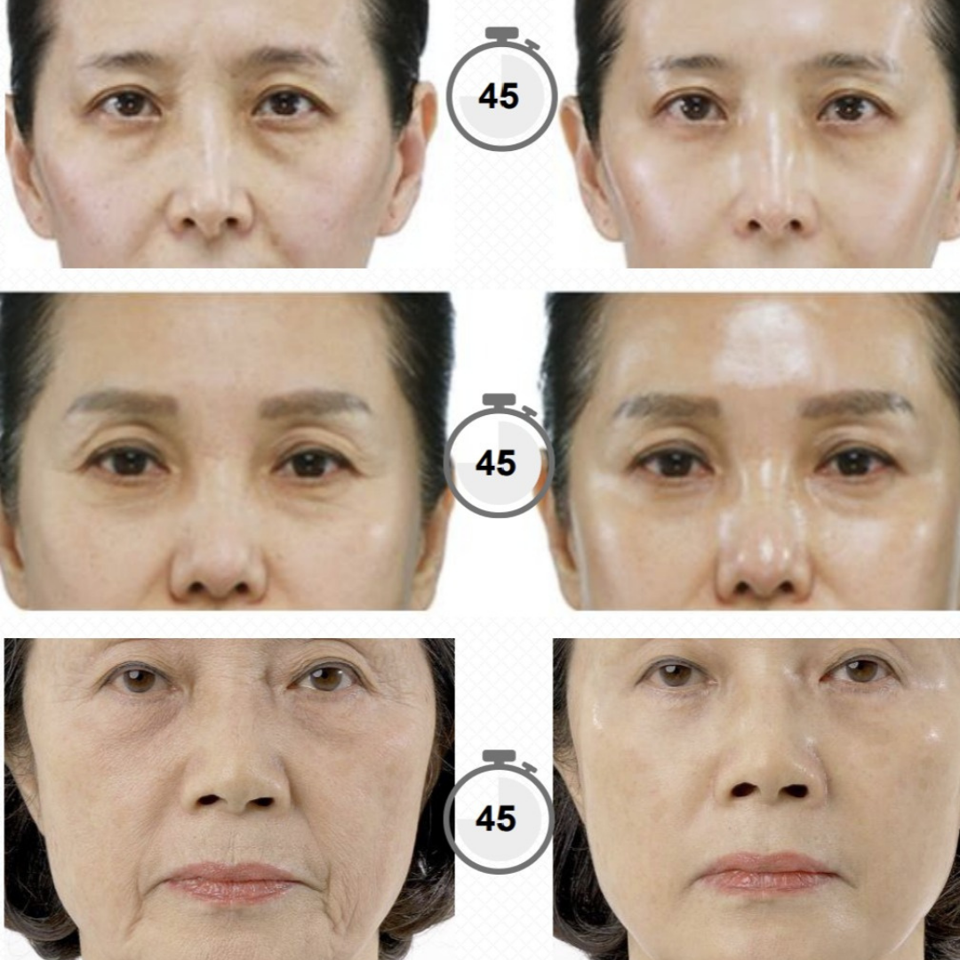 Anti-aging silně liftingová maska s okamžitým účinkem